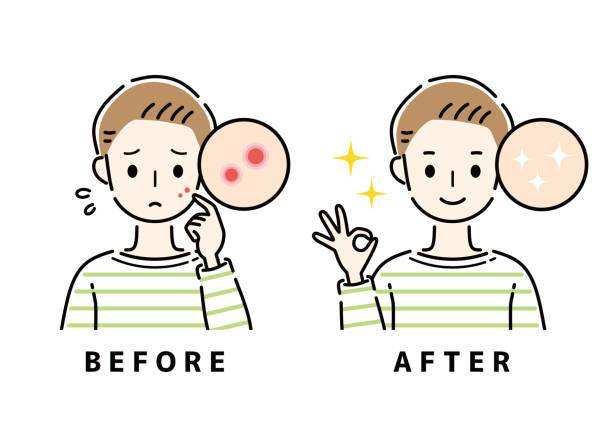 DEBBIEG.cosmetics Acne Spot Care (Limited Edition) - DEBBIEG.